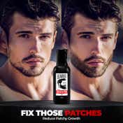 Beardo Beard & Hair Growth Oil (30 ml)