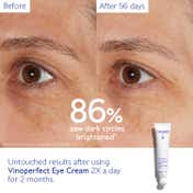 Caudalie Vinoperfect Brightening Eye Cream (15 ml)