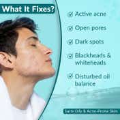 Fixderma 2% Salicylic Acid with 5% Azelaic Acid & 4% Mandelic Acid & Anti Acne Face Serum (15g)