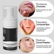 House of Beauty Anti Acne Foaming Facewash For Oily & Combination Skin W-T Salicylic (100 ml)