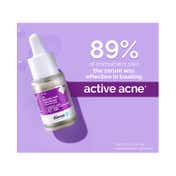 The Derma Co. 2% Salicylic Acid Serum With Witch Hazel & Willow Bark (10ml)