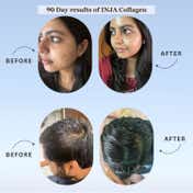 INJA Beauty Marine Collagen for Skin, Hair & Nails - Lychee Flavour (125 g)