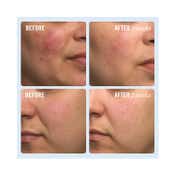 First Aid Beauty Ultra Repair Cream (170.1g)
