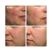 First Aid Beauty Ultra Repair Cream (226g)