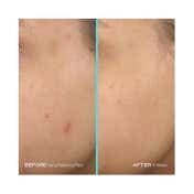 First Aid Beauty Facial Radiance Pads - (28 Pcs)