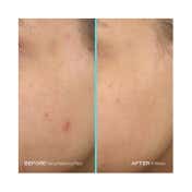 First Aid Beauty Facial Radiance Pads - (60 Pcs)