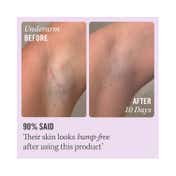 First Aid Beauty Ingrown Hair Treatment Pads - (28 Pcs)