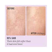 First Aid Beauty KP Bump Eraser Body Scrub With 10% AHA (56.7g)