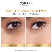 L'Oreal Paris Glycolic Bright Dark Circle Eye Serum (20ml)