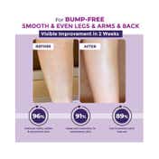 Sanfe Bumps Erasing Body Scrub For Rough Bumpy Skin Tan Strawberry Legs Remove Dirt (100g)