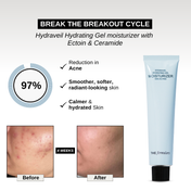 The Formularx Hydraveil Hydrating Gel Moisturizer Pack of 2 Combo (2 x 50 g)