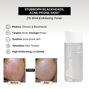 The Formularx 2% BHA Exfoliator With 2% Salicylic Acid & 2% Niacinamide for Oily Skin (100 ml)