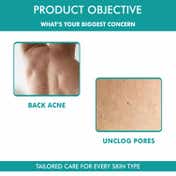 THE LOVE CO. Bacne Warrior Acne Fighting Body Spray With 02% Salicylic Acid + Niacinamide (100ml)