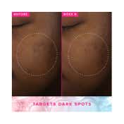 Farmacy Beauty Brighten Up 3% TXA Dark Spot Toner (120 ml)