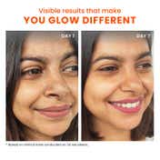 Foxtale The Diva Over Night Glow Mask, For All Skin Types (30ml)
