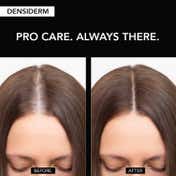 O3+ Women Densiderm Hair Growth Serum Scalp Spray with Hair Fall Control & Hair Growth (50 ml)