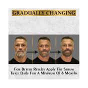 Mancode Anti Grey Hair & Beard Serum For Men (30 ml)