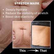 House of Beauty Stretch Mark Oil (50 ml)