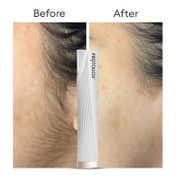 Protouch Dermaplaning Device Electric 2 in 1 Eyebrow and Face Hair Remover (250 g)
