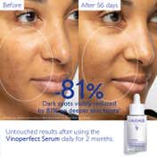 Caudalie Vinoperfect Brightening Dark Spot Serum (30 ml)