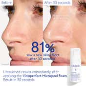 Caudalie Vinoperfect Instant Brightening Micropeel (100 ml)