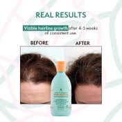 Nature Spell Growth Complex Shampoo - Sulphate Free (300 ml)