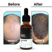 Thriveco Hair Growth Serum 2.0 (30 ml)