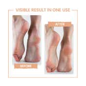 Protouch Bliss Callus Remover