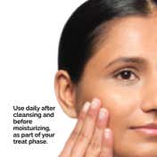 The Ordinary Aloe 2% + NAG 2% Solution Face Serum for Reduced Post-Acne Marks & Improved Texture (30 ml)