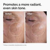 The Ordinary Glycolic Acid 7% Exfoliating Toner (100 ml)