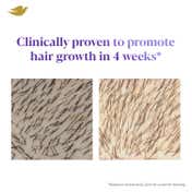 Dove Scalp+Hair Therapy Density Boost Revitalizing Scalp Serum (50 ml)