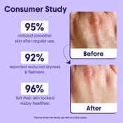 Aravi Organic 10% AHA + BHA Body Lotion (200 ml)