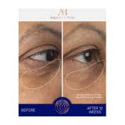 Augustinus Bader The Eye Cream (15 ml)