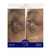 Augustinus Bader The Eye Cream (15 ml)