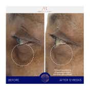 Augustinus Bader The Eye Cream Nomad (15 ml)