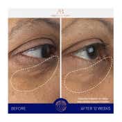 Augustinus Bader The Eye Cream Nomad (15 ml)
