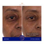 Augustinus Bader The Eye Patches (Pack of 6)