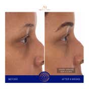 Augustinus Bader The Eye Patches - Single (3 g)