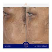 Augustinus Bader The Serum (50 ml)