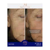 Augustinus Bader The Ultimate Soothing Cream (50 ml)