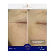 Augustinus Bader The Ultimate Soothing Cream (50 ml)