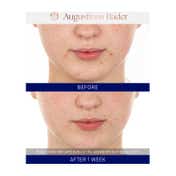 Augustinus Bader The Retinol Serum (30 ml)