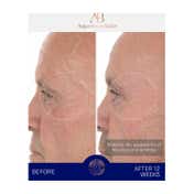 Augustinus Bader The Retinol Serum (30 ml)