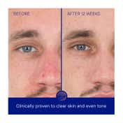 Augustinus Bader The Retinol Serum (50 ml)