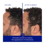 Augustinus Bader The Retinol Serum (50 ml)