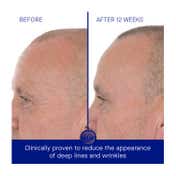 Augustinus Bader The Retinol Serum (50 ml)