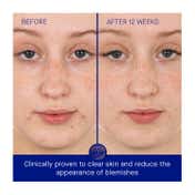 Augustinus Bader The Retinol Serum (50 ml)