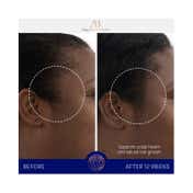 Augustinus Bader The Scalp Treatment (30 ml)
