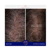 Augustinus Bader The Scalp Treatment (30 ml)