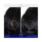 Augustinus Bader The Scalp Treatment (30 ml)